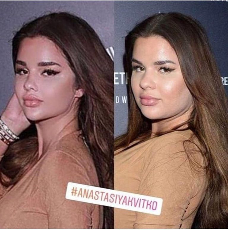 15 Pictures That Prove Everything On Istagram Is a Big Lie 7 15 Pictures That Prove Everything On Istagram Is a Big Lie