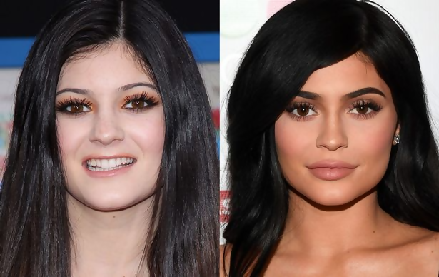 Check Out This List of Celebrities Whose Looks Changed For The Good (Or Worse!) After Plastic Surgery