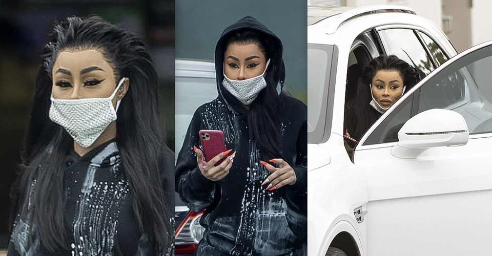 15 Botched Beauty Surgeries That Make You Question People’s Sanity