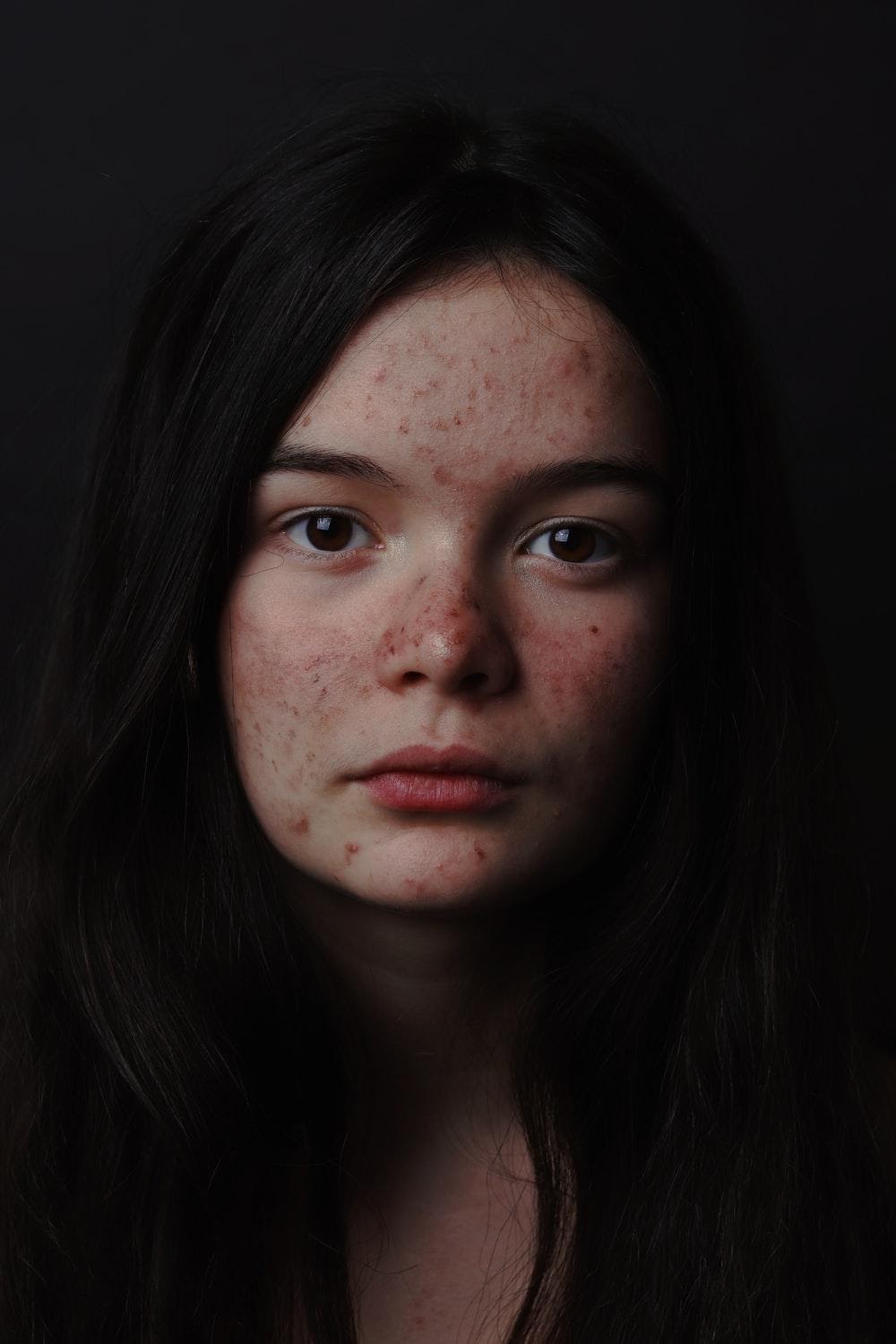 9 Of The Most Dangerous Social Media Skin-Care Myths That You Should Avoid