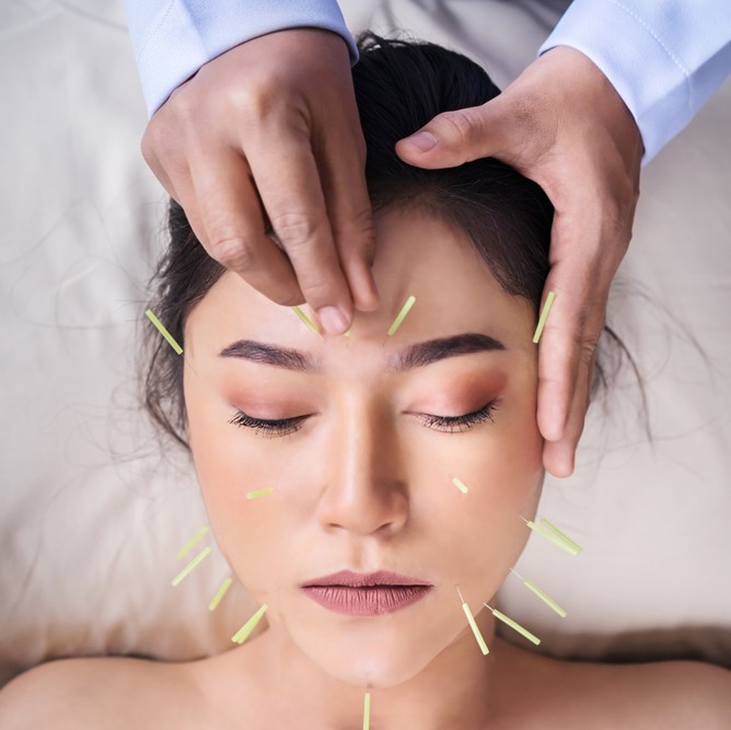 Is Acupuncture the Natural Anxiety Medicine You’ve Been Looking For?