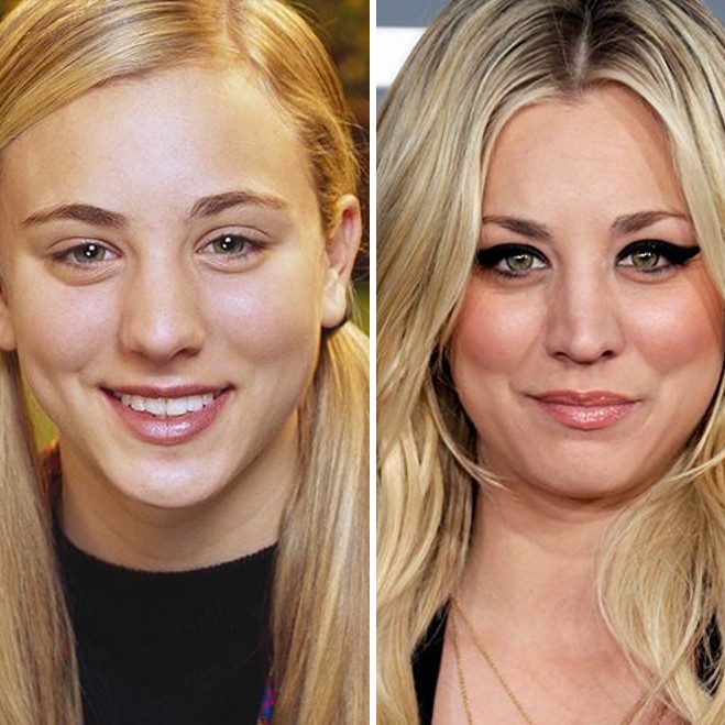 20 Celebrities’ Nose Jobs: Before and After Photos