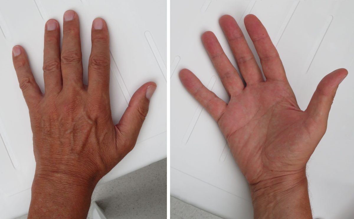 What Does Finger Length Reveal About a Man’s True Personality?